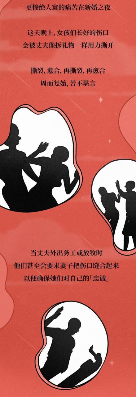 女子割礼后的外观(女子割冠礼照片)插图11