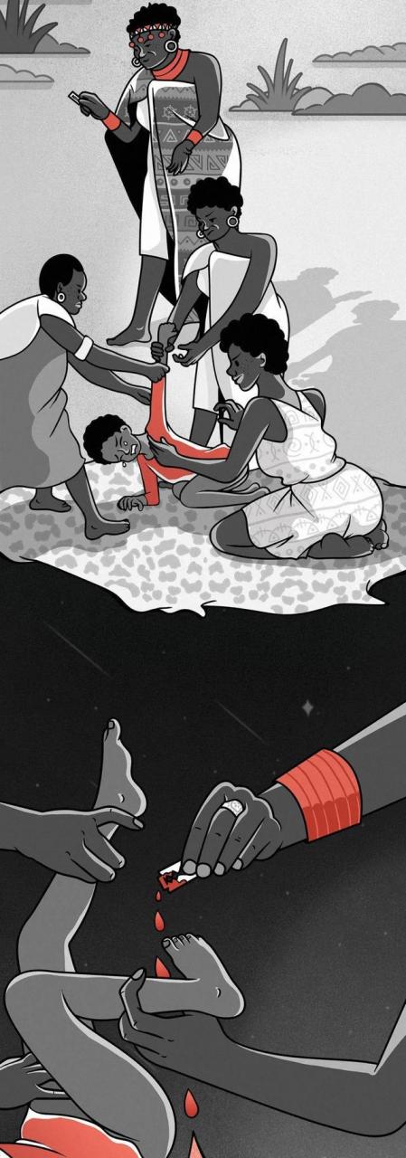 女子割礼后的外观(女子割冠礼照片)插图2