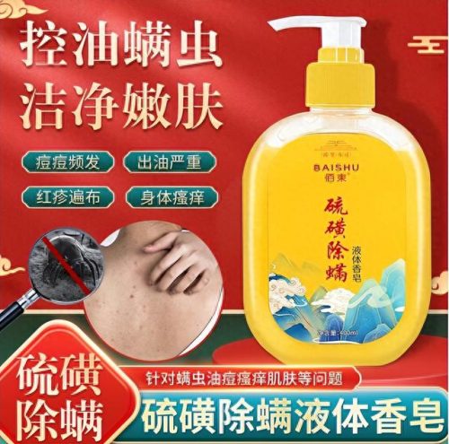 国货排行榜硫磺皂十大品牌(正宗硫磺皂哪个品牌好)插图2