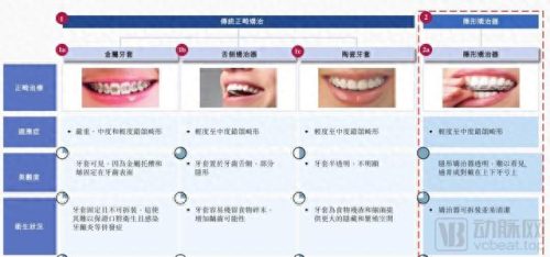 矫正器十大品牌排行榜图片(国内矫正器哪个牌子好)插图3