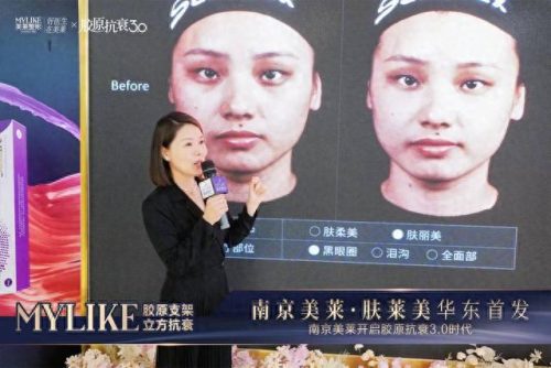河北高端抗衰产品排名前十(逆美诺抗衰饮多少钱)插图4
