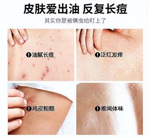 国货排行榜硫磺皂十大品牌(正宗硫磺皂哪个品牌好)插图4