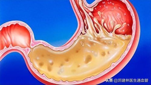 2020十大小苏打排行榜(小苏打各个地区叫法)插图9
