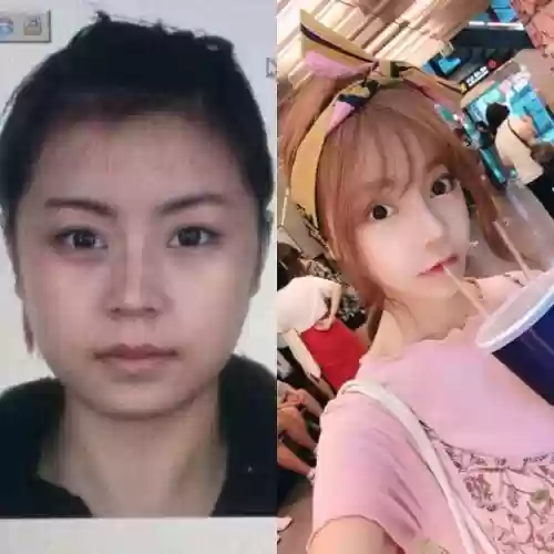 全国十大专业整形医院(深圳十大整形医院排名)插图